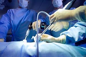 актуальные вопросы эндохирургии. эндохиругический шов