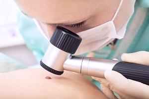 актуальные вопросы онкодерматологии