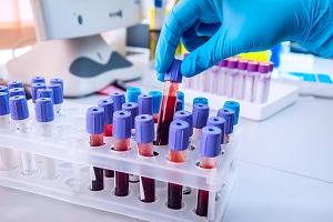 гематология