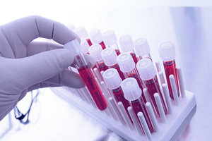 лабораторная гематология