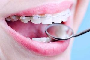 ортодонтия