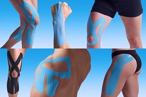 основы кинезиологического тейпирования