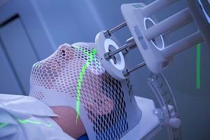 радиотерапия