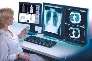 рентгенэндоваскулярные диагностика и лечение